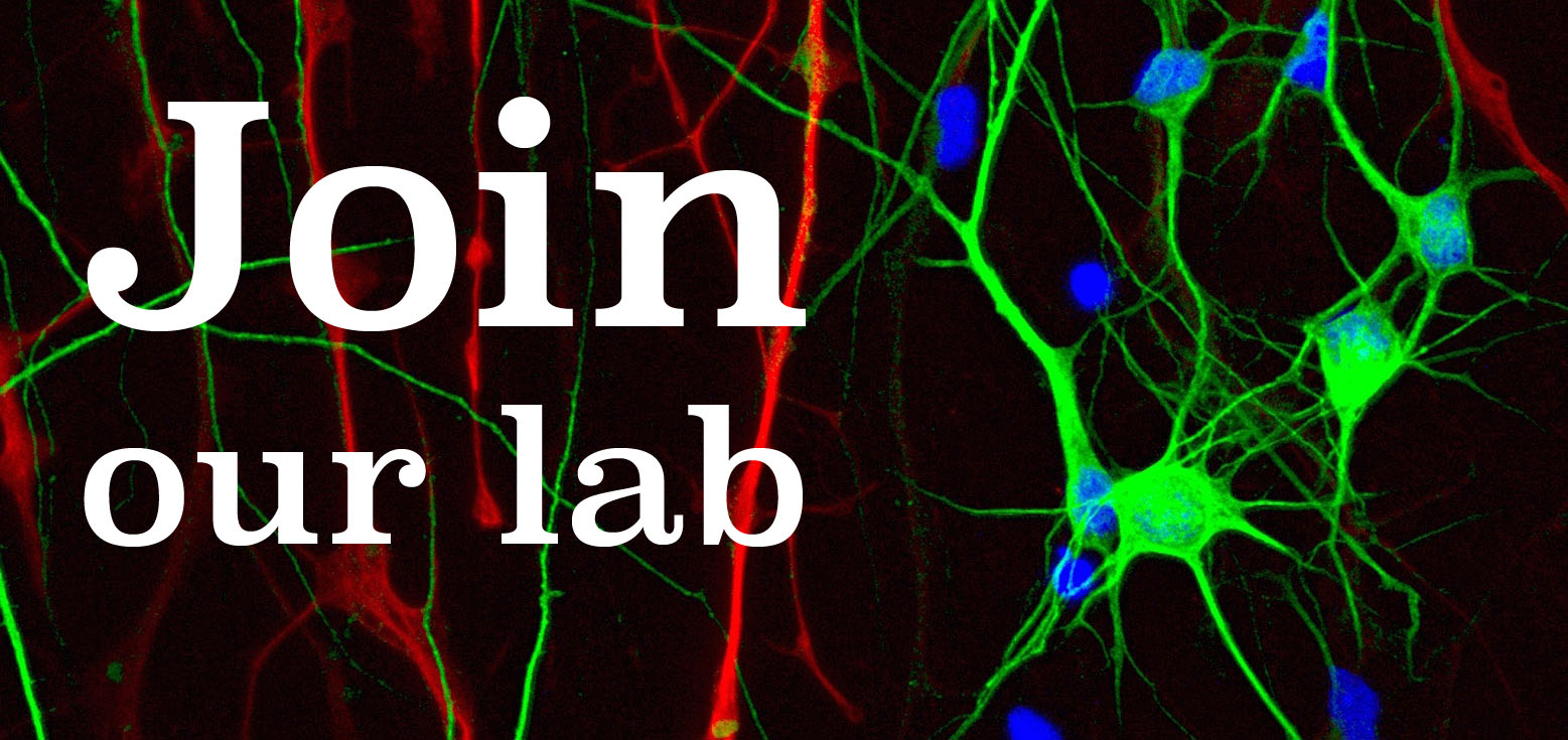 join our lab – CONSIGLIO LAB